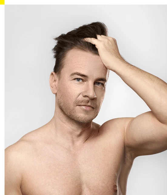 Hombre con cabello denso y fuerte, resultados de Folicerin.